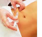 Mesoterapia Precio en Alicante