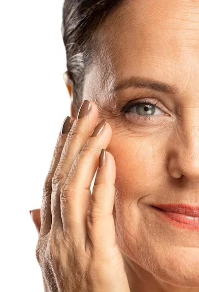 PEELING QUÍMICO, Facial en Orihuela